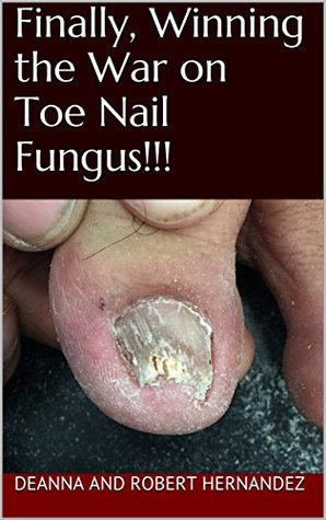 Read Finally, Winning the War on Toe Nail Fungus!!! - Deanna Hernandez | PDF