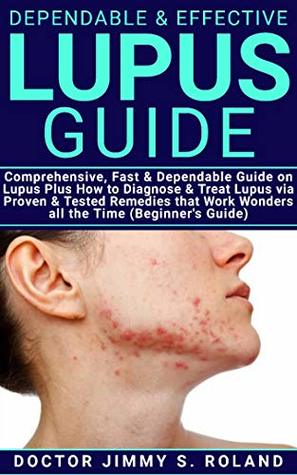 Read Online Dependable & Effective Lupus Guide: Comprehensive, Fast & Dependable Guide on Lupus Plus How to diagnose & Treat Lupus via Proven & Tested Remedies that Work Wonders all The Time (Beginner’s Guide) - DR. JIMMY S. ROLAND | PDF
